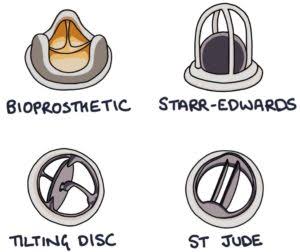 الفرق بين الصمام الميكانيكي و الحيوي للقلب